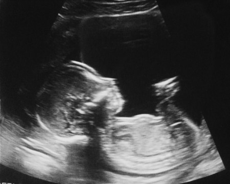 Processed with VSCOcam with b1 preset