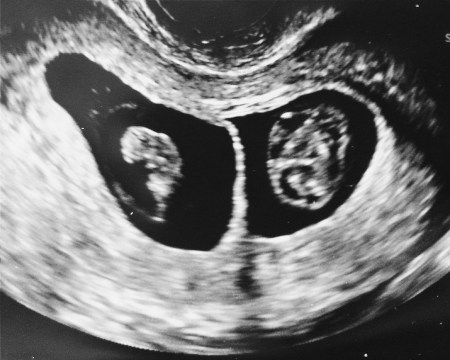 Processed with VSCOcam with b1 preset