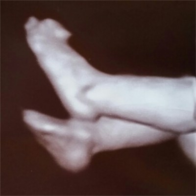 PhotoGrid_1426313059518 (1)