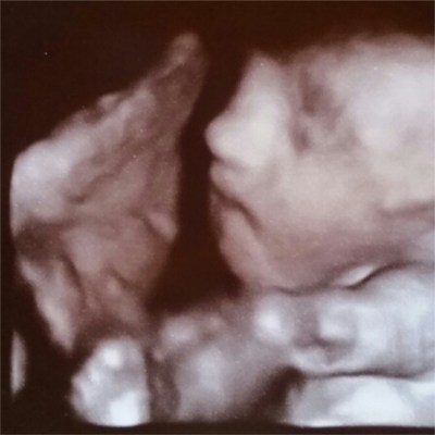 PhotoGrid_1426313113112